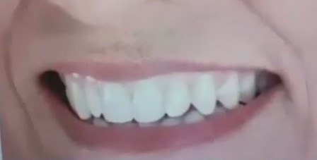 ترکیب زیبایی سافت The soft Esthetic Composition
